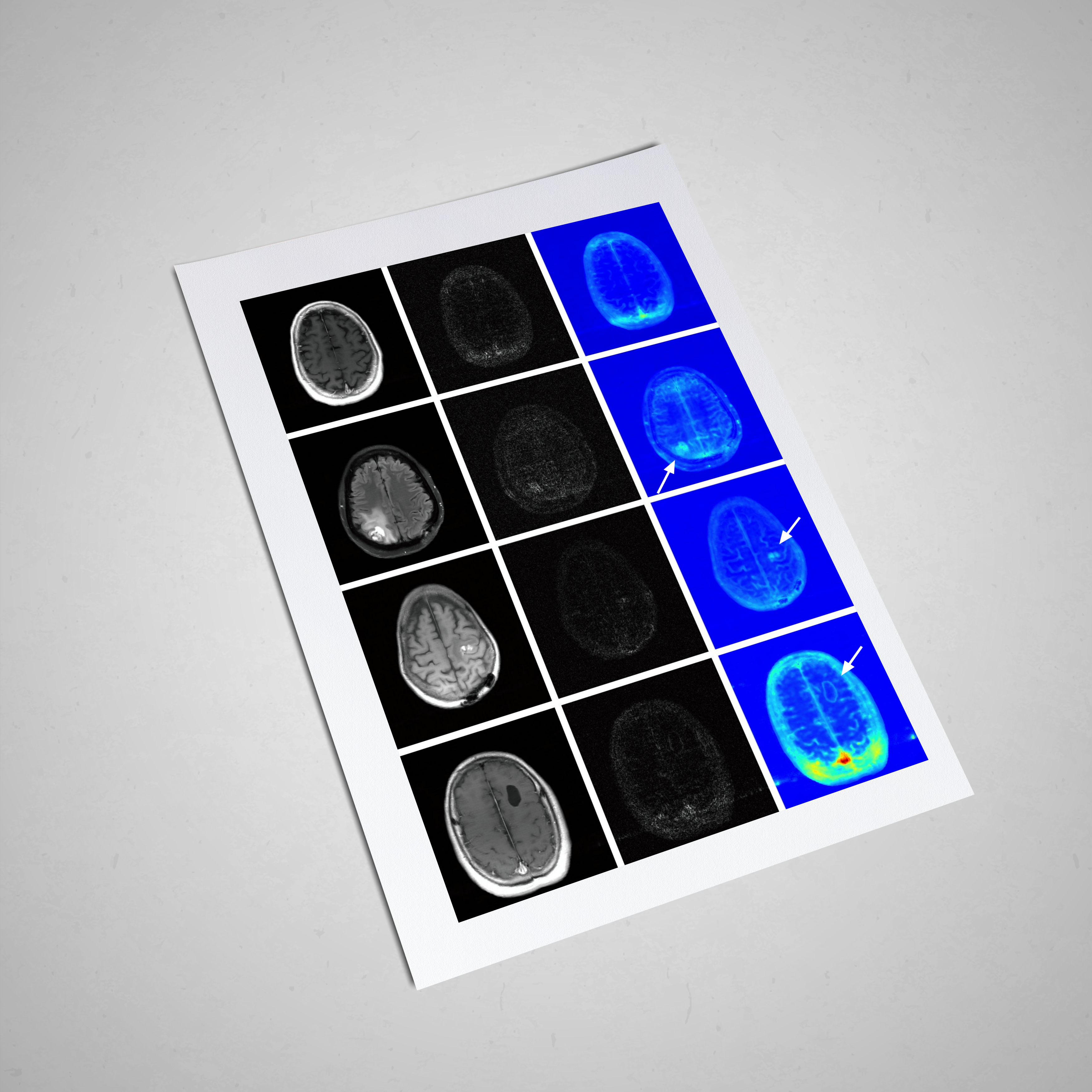 Uncertainty Quantification